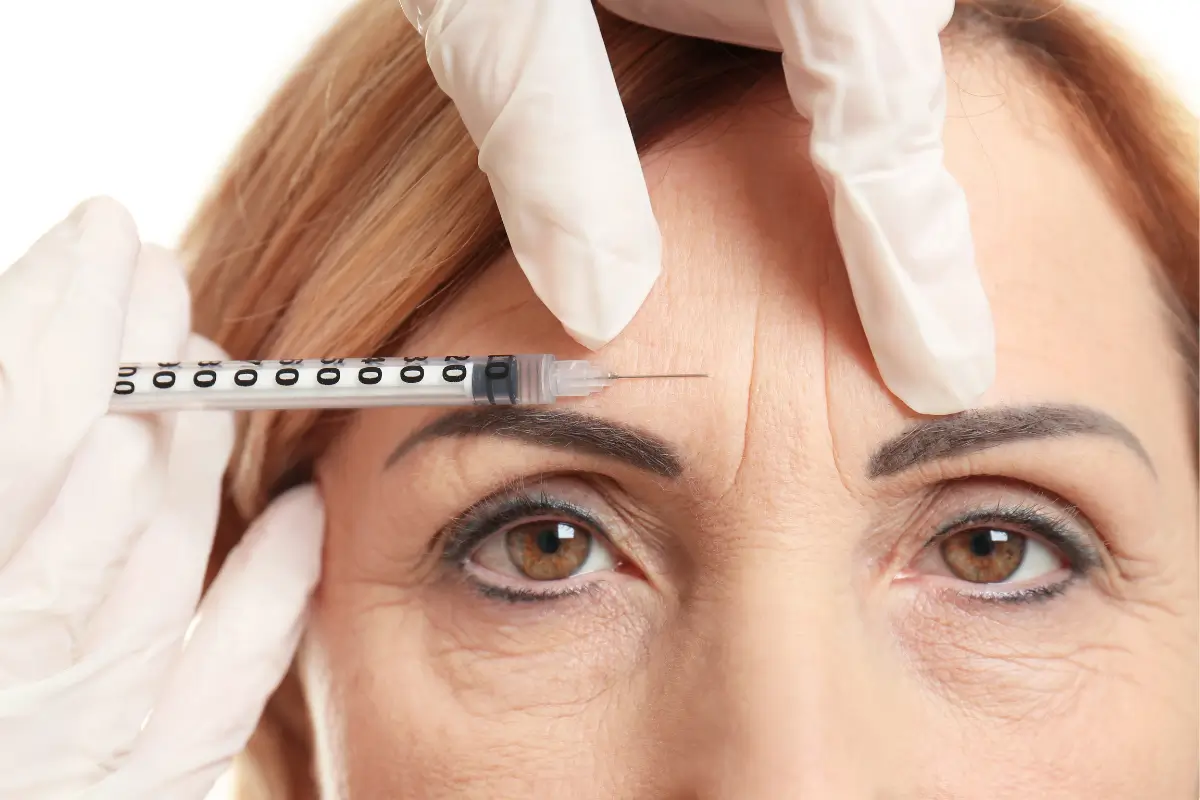 Aplicação de botox para rugas e linhas de expressão