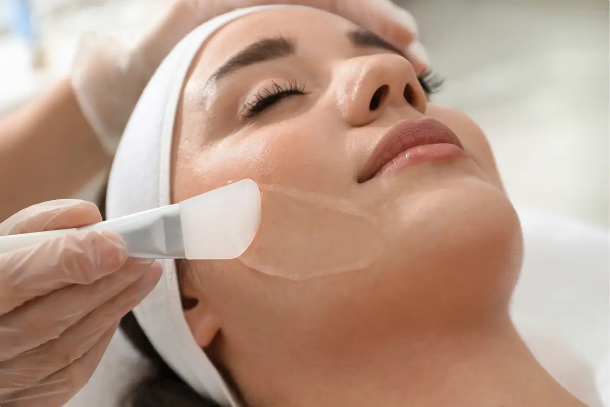 Peeling químico facial